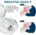 Anti Snoring Nose Clip Device for Men Women Nasal Strips Stops Snoring Stopper Anti-snoring Device (Nose Clip) - Pack of 1 , 2